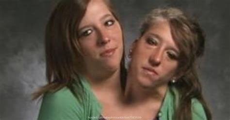 Conjoined Twins Have Sex New Porno