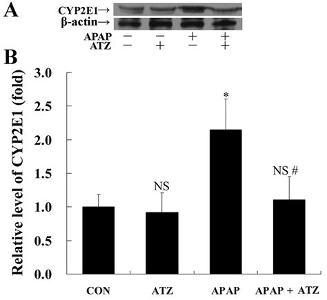 Pretreatment With Atz Decreased The Level Of Cyp2e1 In Apap Exposed
