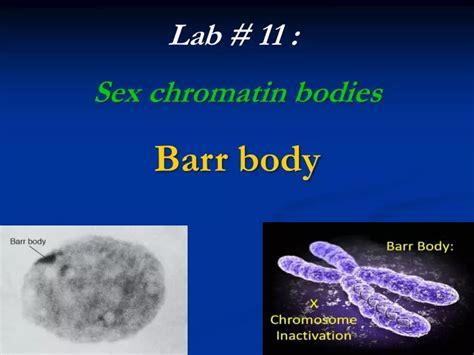 Ppt Lab 11 Sex Chromatin Bodies Barr Body Powerpoint Presentation