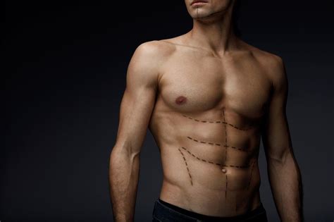 Plastic Surgery For Men Why Butt And Pec Implants Are On The Rise