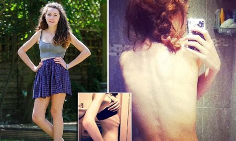 thinspiration selfies nearly killed me says recovering