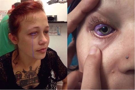 This Model S Eyeball Tattoo Went Horribly Wrong And Left