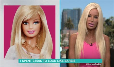 woman fails to look like doll after £350 000 surgery tv and radio