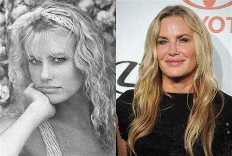 worst cases of celebrity plastic surgery gone wrong