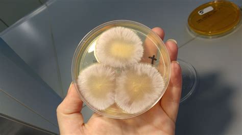 fusarium oxysporum front sabouraud plate