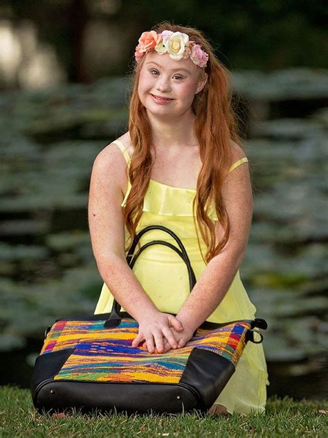 Madeline Stuart Model With Down Syndrome Lands Two New