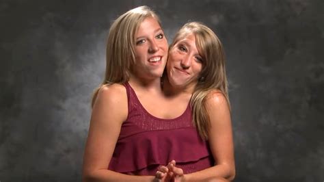 the conjoined twins abby and brittanny frontlines media