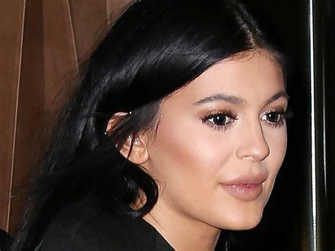 kylie jenner lip fillers experts explain the medical and