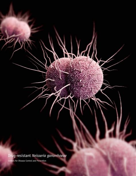 Nearly Untreatable Gonorrhea Spreading Globally Nbc News