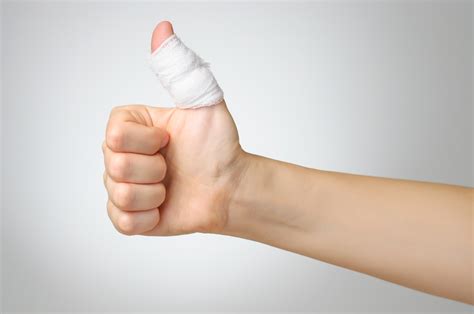 sprained thumb   recovery time orthoindy blog