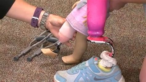 Girl With Prosthetic Leg Gets A Look Alike Doll Wish Tv