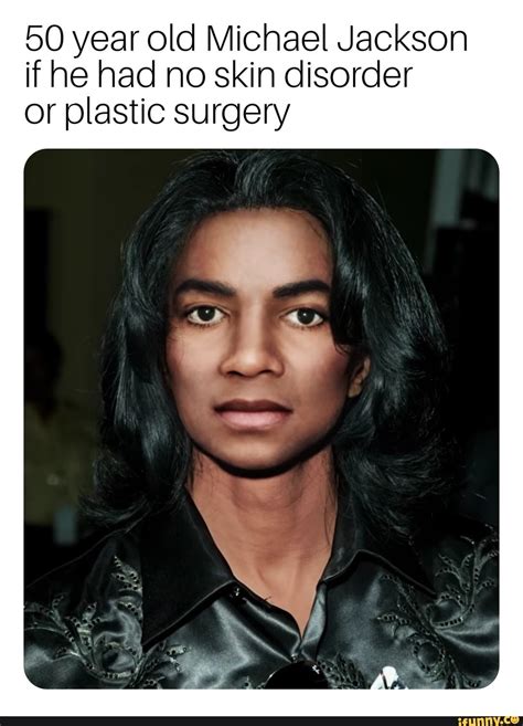 year  michael jackson     skin disorder  plastic surgery popular memes