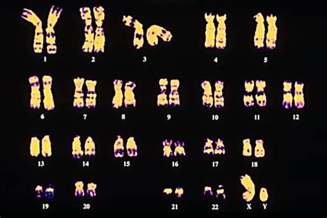 Genetics Cromosomal Variations