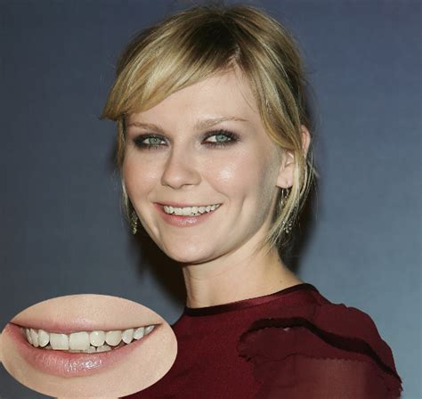 celebrities who won t fix their teeth