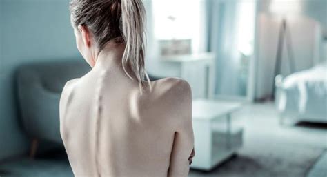 Causas Y Factores De Riesgo De La Anorexia Salud Al Día