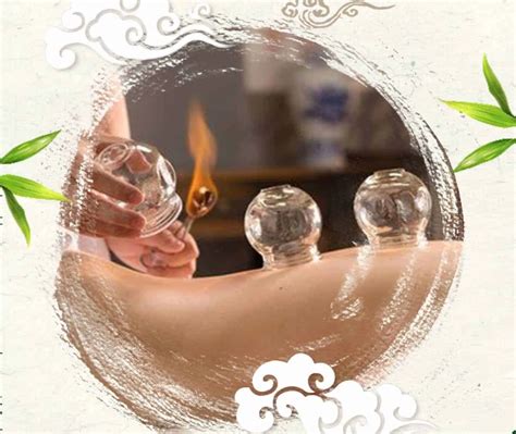 effectively  cupping therapy  home  chinese recipes