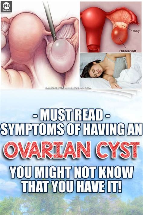 must read symptoms of having an ovarian cyst you might not know that