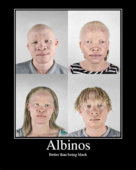 Albinos Picture Ebaum S World