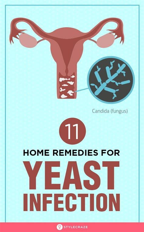 Can You Have A Yeast Infection Without Discharge Can Yeast Infection