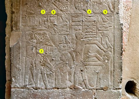 History Ancient Egypt Circumcision