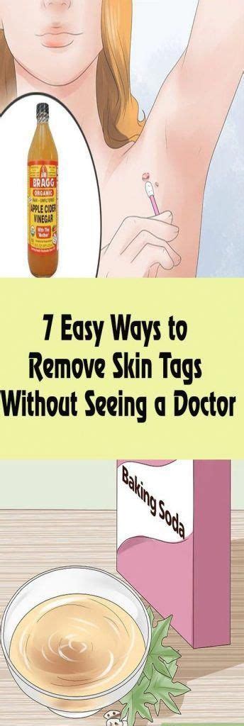 7 easy ways to remove skin tags without seeing a doctor