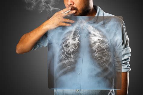 Risk Of Lung Cancer After Quitting Smoking Archives Tidatabase