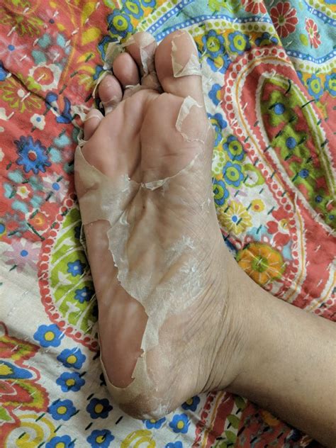 tried and tested korean foot peel skin peeling korean