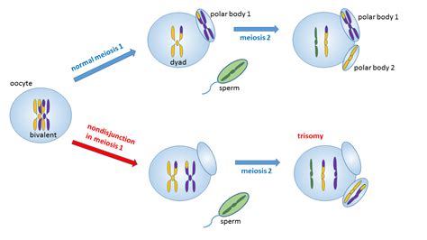 development klinefelter syndrome 101