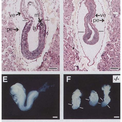 pdf disruption of the hnf 4 gene expressed in visceral endoderm