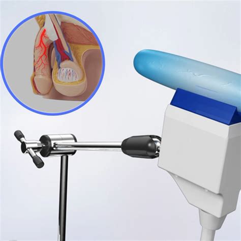 Shockwave Therapy Erectile Dysfunction View Shockwave Therapy Device