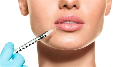 aftercare tips  lip fillers healthmedline