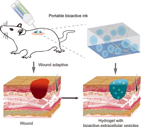 wound healing ink  high tech    replace bandages