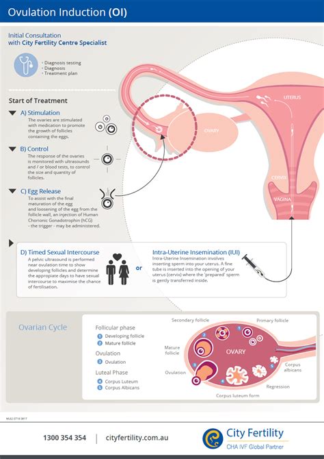 ovulation induction fertility treatment city fertility