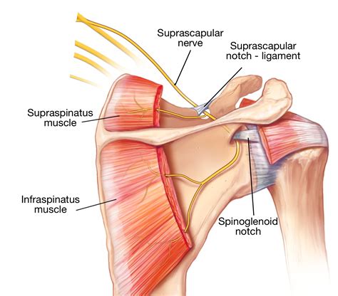 tiny nerve   shoulder  create   trouble