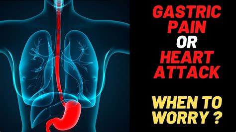 Gastric Pain Vs Normal Chest Pain Vs Heart Attack Pain When To Worry