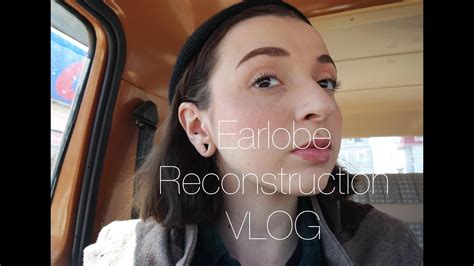 earlobe reconstruction vlog youtube