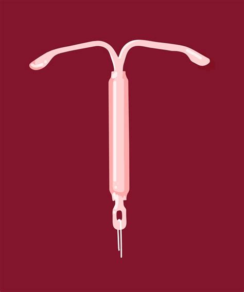 iud birth control types contraceptive method facts
