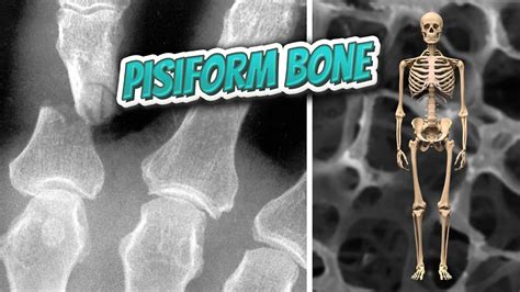 pisiform bone  human anatomy bones youtube