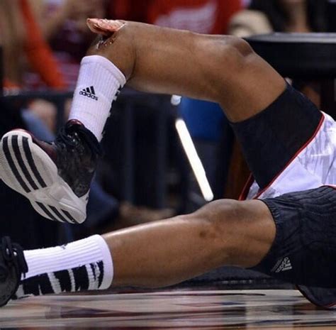 kevin ware broken leg    worst injuries  sports history warning  graphic