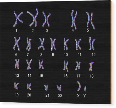 Normal Male Chromosomes Photograph By Kateryna Kon Science Photo Library