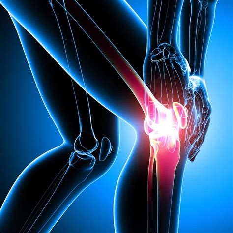 treating  arthritic knee current concepts  rehabilitation