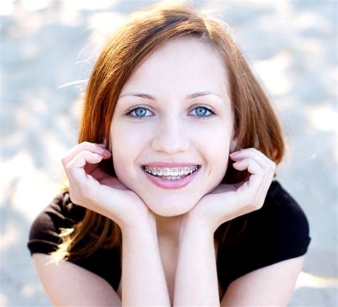 Braces Myofunctional Therapy Exercises For Mouth