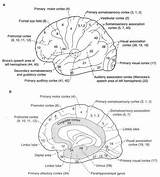 Brodmann Anatomy Cortex Cerebral Neurology Wernicke sketch template