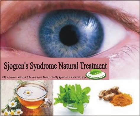 8 natural treatment sjogren s syndrome dry eyes herbs solutions by nature