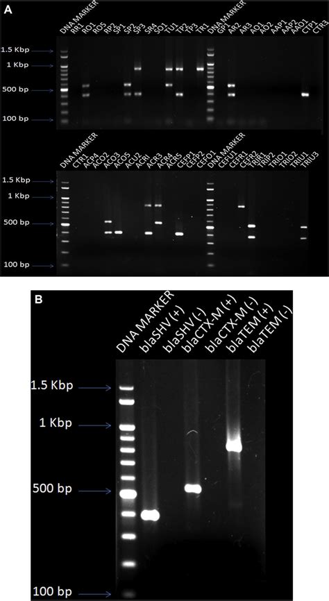 detection  esbl genes   test isolates  pcr amplicons    scientific