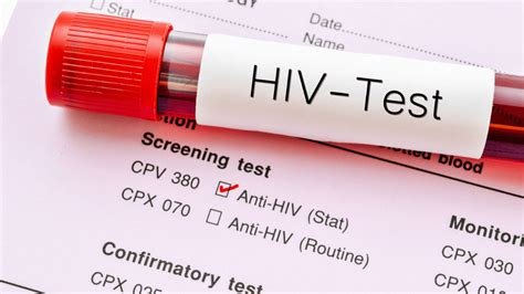 department of health recorded 36 new hiv cases