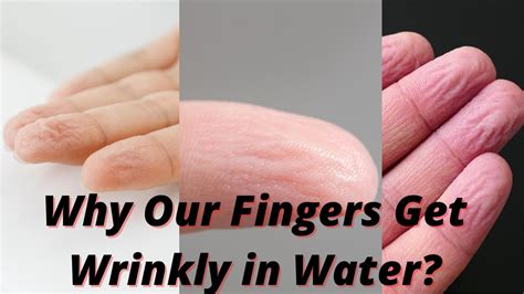 why our fingers get wrinkly in water [intresting answer of why our