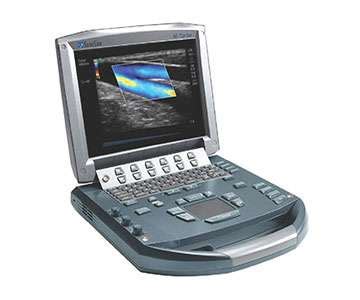 sonosite  turbo portable ultrasound  arms    rentals