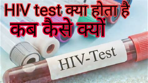 Hiv Test Kya Hota Hai Kase Aur Kyo Hota Hai In Hindi Youtube