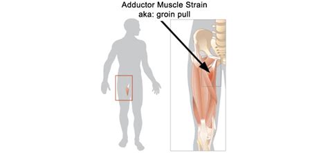 Do You Experience Lower Limb Muscle Strains Preventing And Treating